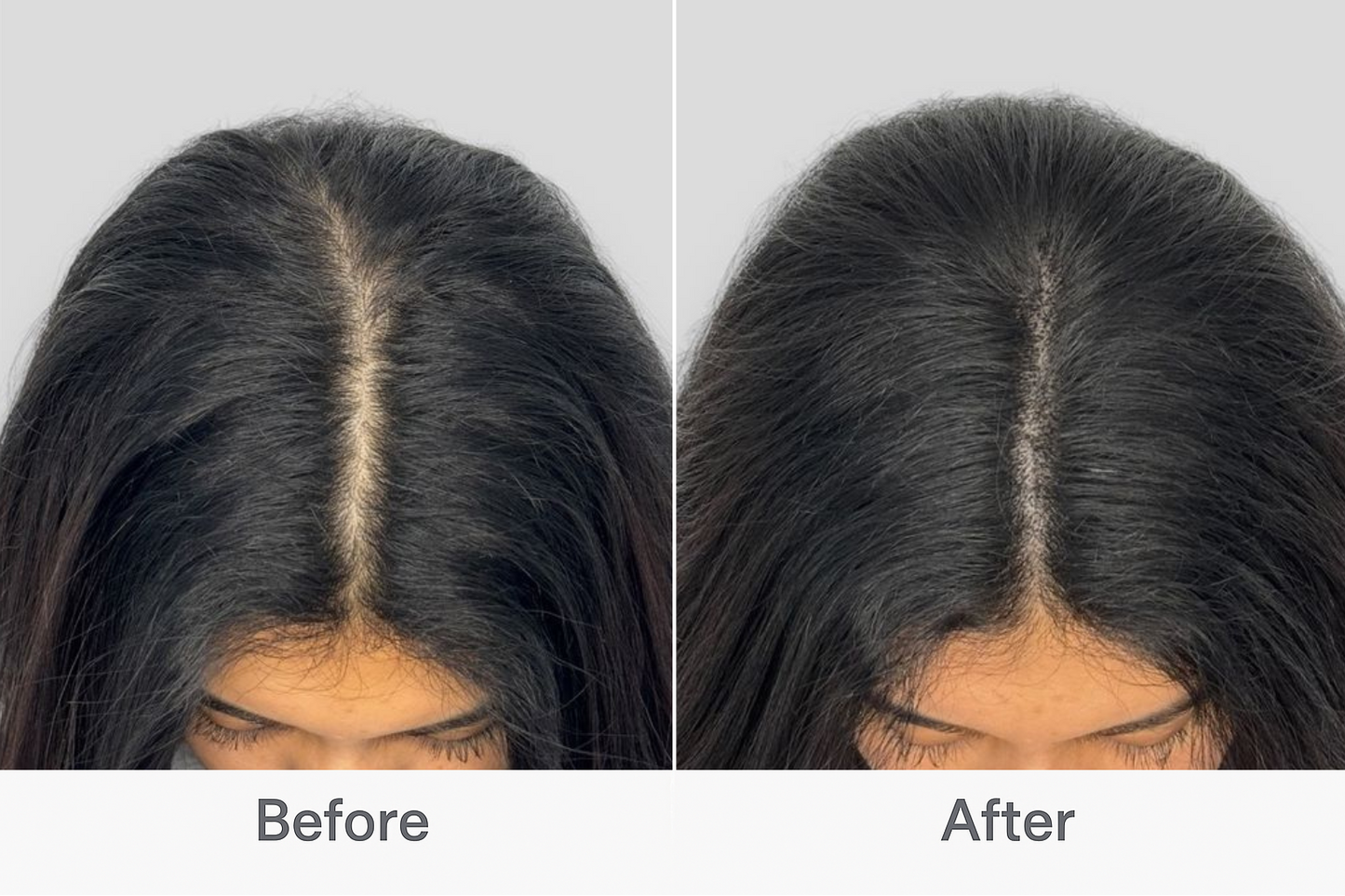 EraBrush™ + Hair Scalp Massager Brush for Hair Growth